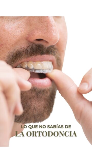 La ortodoncia no solo sirve para alinear los dientes, también corrige la posición de los maxilares. Y es que una mordida que no funciona bien puede acabar provocando otros problemas.

Aunque solemos asociarla a niños y adolescentes, lo cierto es que es un tratamiento para cualquier edad. De hecho, cada vez más adultos se animan a empezar su tratamiento de ortodoncia

Puedes visitarnos en 
📍Calle Benartemi, 36 | Estudio Dental Integral 
☎️ 928073905 📲 626869680

#ortodoncia #dentistalaspalmas #tratamientodental #sonrisaalineada #odontología